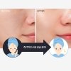 Тканевая маска A'Pieu Chi Ka Po Ka Tooth Brushing Mask