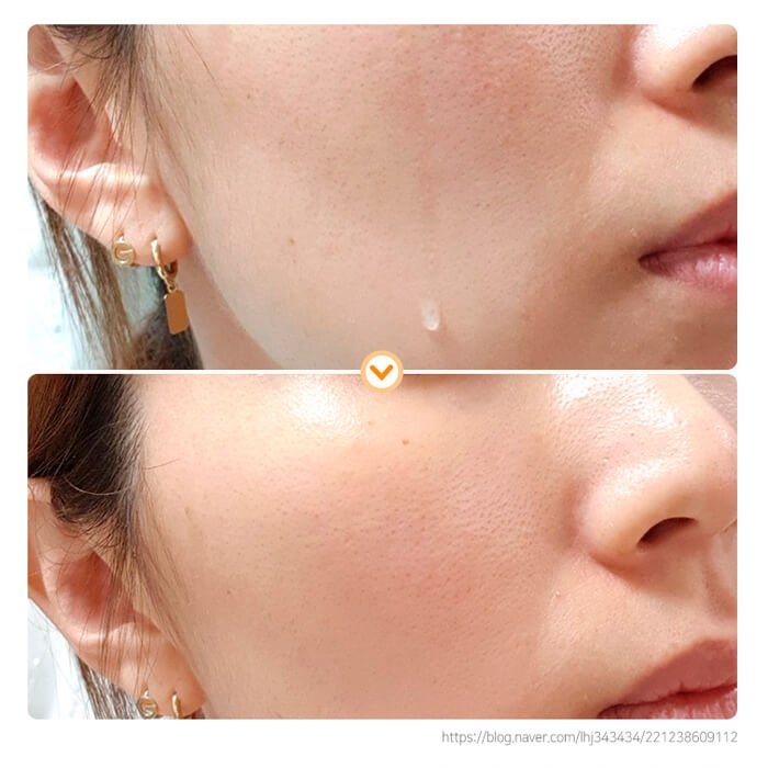 Сыворотка для лица Elizavecca Milky Piggy Bifida 100%