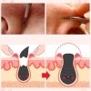 Набор от чёрных точек Nightingale Tako Pack Nose (5 уп.)