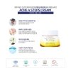 Крем для лица Ph.Drop Acne 4 Steps Cream